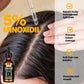 5% Minoxidil Hair Growth Serum Oil For Men and Women, Biotin Hair Serum, Safest Hair Regrowth Treatment, Prevent Scalp Hair Loss 60ml / 2.11 fl.oz