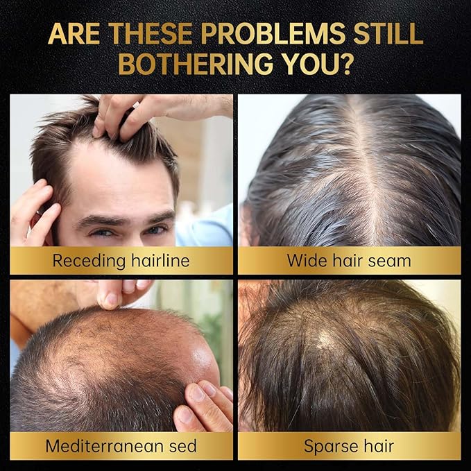 Minoxidil for Men & Women, With Biotin, Batana Oil, Rosemary Essential Oil, Effective Hair Loss Solution,