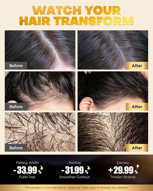 Tripeptide-Infused Hair Growth Biotin Shampoo and Conditioner Set, Onion Anti-Loss Volumizing Moisturizing Treatment for Soft Shine Hair, Dandruff Routine Rosemary Shampoo for Men and Women, 2x16.9oz